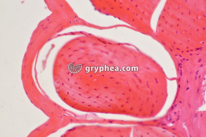 Tendon CT x100 - gryphea.com